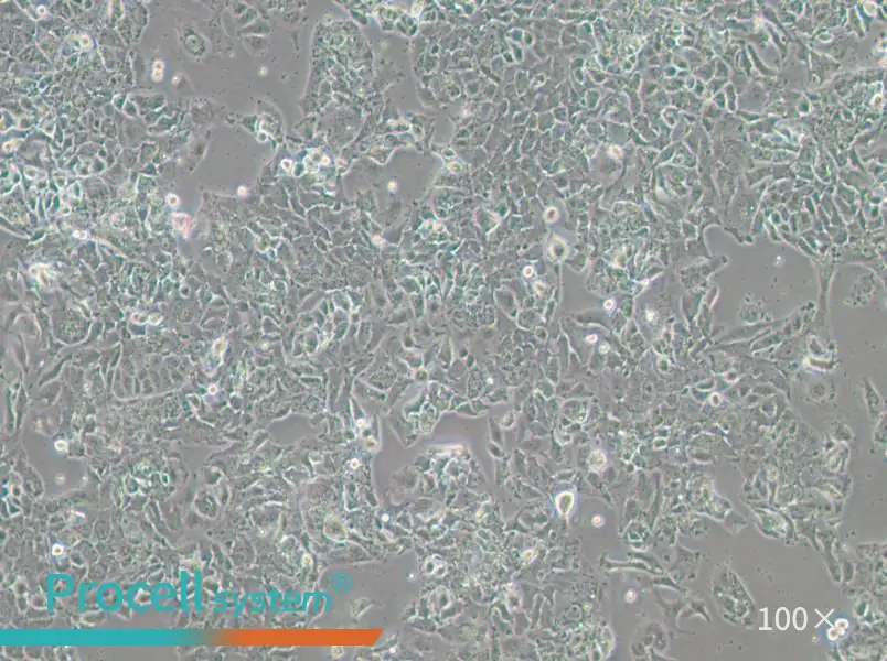 OV-90 Cell Complete Medium - 2