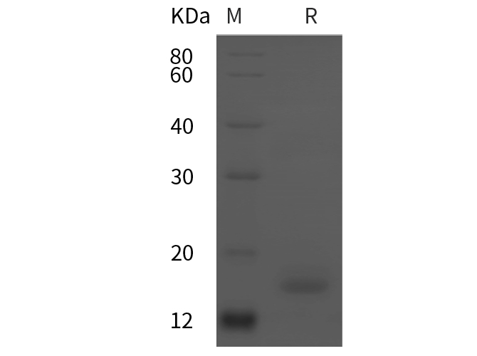 Recombinant Human CEACAM8/CD66b/CD67 Protein(His Tag)-产品推荐-1