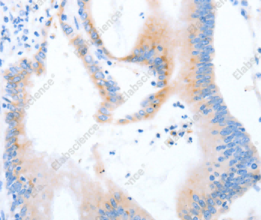 STK4 Polyclonal Antibody - 3