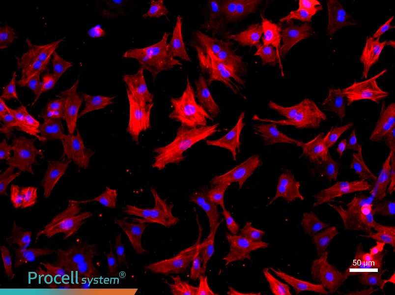 Rat Great Saphenous Vein Smooth Muscle Cell Complete Medium - 1