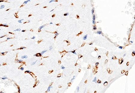 Recombinant CD38 Monoclonal Antibody - small - 2
