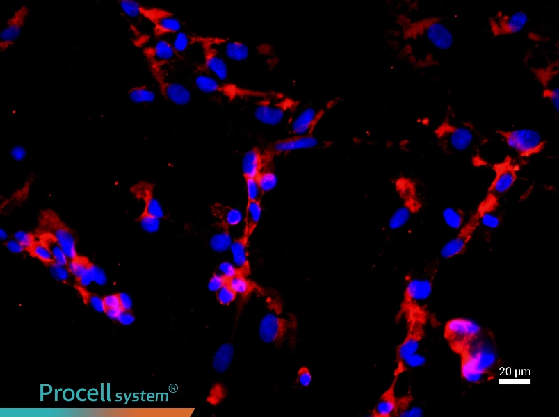 Human Pulmonary Microvascular Endothelial Cell Complete Medium - 2