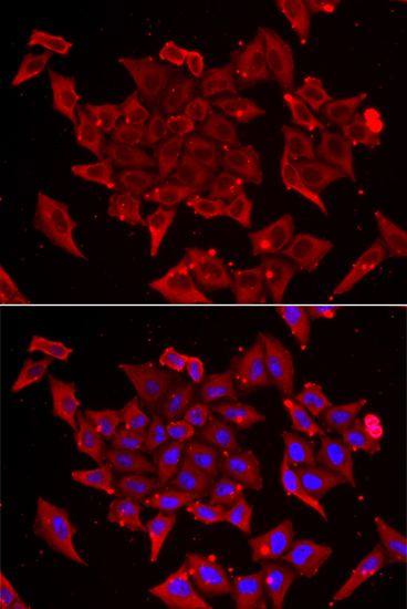 Immunofluorescence analysis of U2OS cells using TIMM17A Polyclonal Antibody Blue: DAPI for nuclear staining.