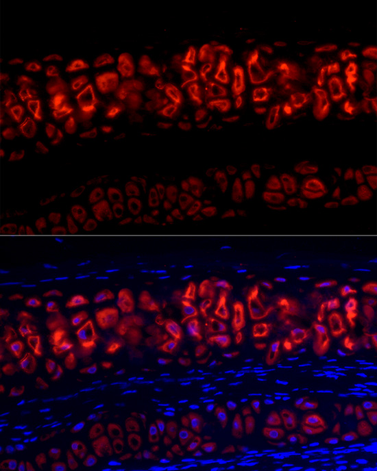 Immunofluorescence analysis of Rat cartilage cells using Aggrecan Polyclonal Antibody at dilution of 1:100 (40x lens).Blue: DAPI for nuclear staining.