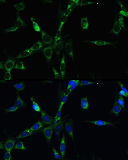 Immunofluorescence analysis of NIH-3T3 cells using BUB1B Polyclonal Antibody at dilution of 1:100. Blue: DAPI for nuclear staining.