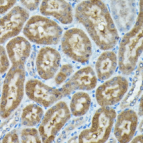 Immunohistochemistry of paraffin-embedded mouse kidney using C9orf72 Polyclonal Antibody at dilution of 1:100 (40x lens).Perform high pressure antigen retrieval with 10 mM citrate buffer pH 6.0 before commencing with IHC staining protocol.