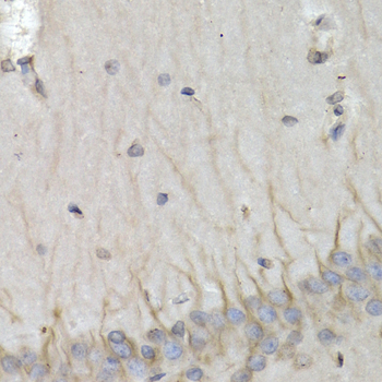 Immunohistochemistry of paraffin-embedded Rat brain using PSMB10 Polyclonal Antibody at dilution of  1:200 (40x lens).