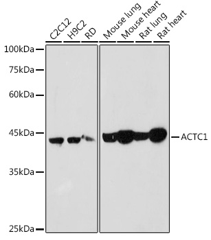 Western blot analysis of extracts of various cell lines using ACTC1 Polyclonal Antibody at 1:1000 dilution.