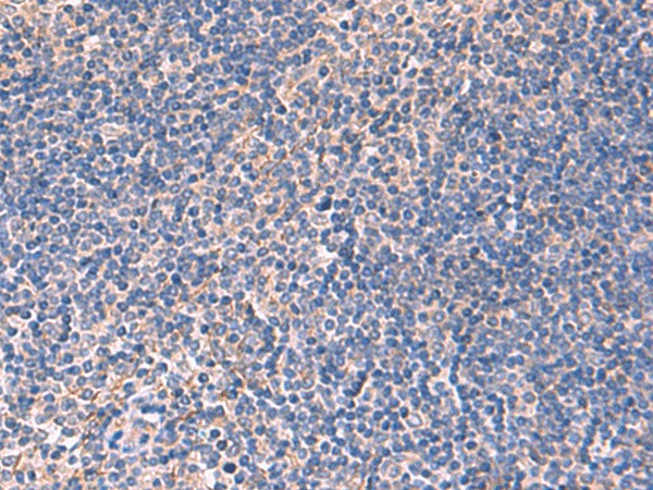 Immunohistochemistry of paraffin-embedded Human tonsil tissue  using INPP5B Polyclonal Antibody at dilution of 1:40(?200)