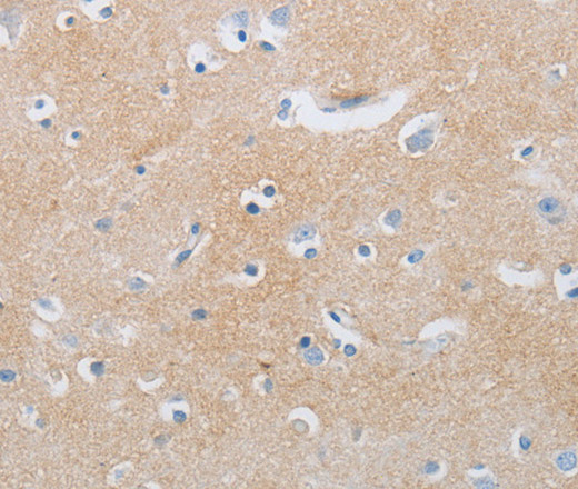 Immunohistochemistry of paraffin-embedded Human brain tissue using CD10 Polyclonal Antibody at dilution 1:85