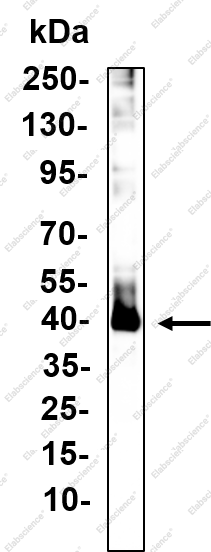 Recombinant LAT1 Monoclonal Antibody - 1