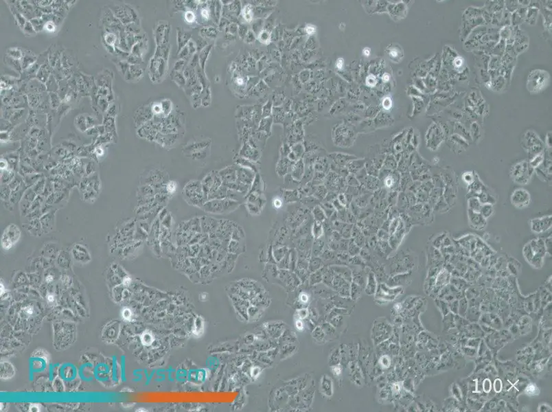 OVCAR-8 Cell Complete Medium - 3