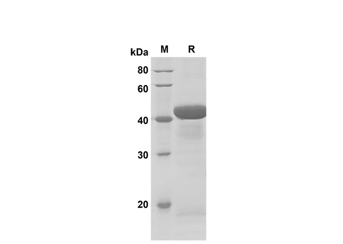 Recombinant Mouse TNFα Protein(His Tag)-产品推荐-1