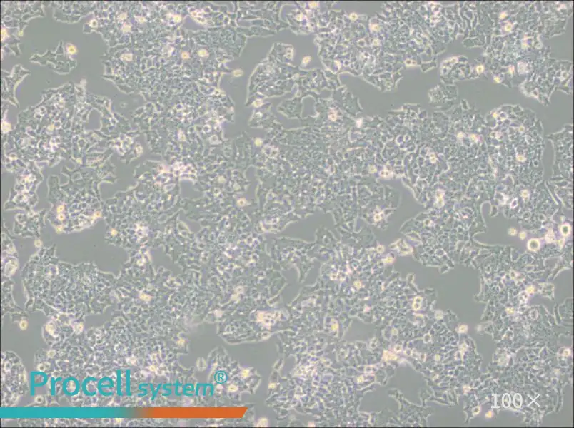 NCI-H520 Cell Complete Medium - 2