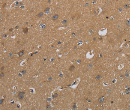 CSH1 Polyclonal Antibody - 3