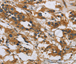 IL5RA Polyclonal Antibody - 2