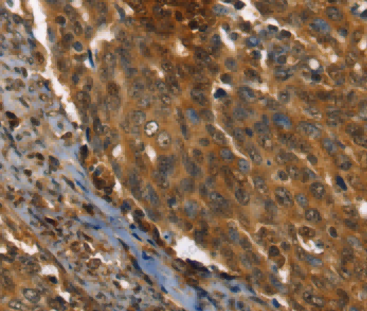 PPIA Polyclonal Antibody - 2