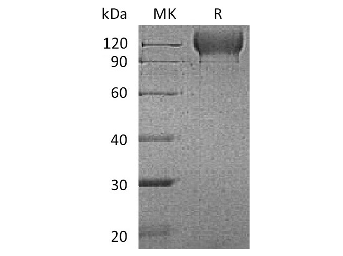 Recombinant Mouse P-selectin/CD62P Protein (AVI & His Tag)