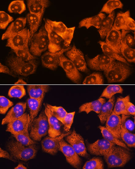 Immunofluorescence analysis of HeLa cells using RPS3 Polyclonal Antibody at dilution of 1:100. Blue: DAPI for nuclear staining.