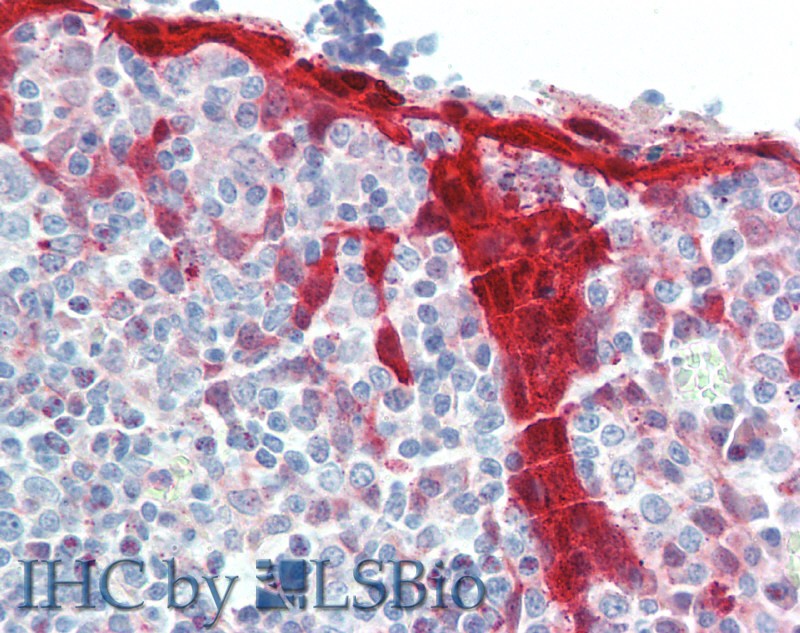 Immunohistochemistry of paraffin-embedded Tonsil tissue using NLRP7 Polyclonal Antibody at dilution of 1:100(Elabscience Product Detected by Lifespan).