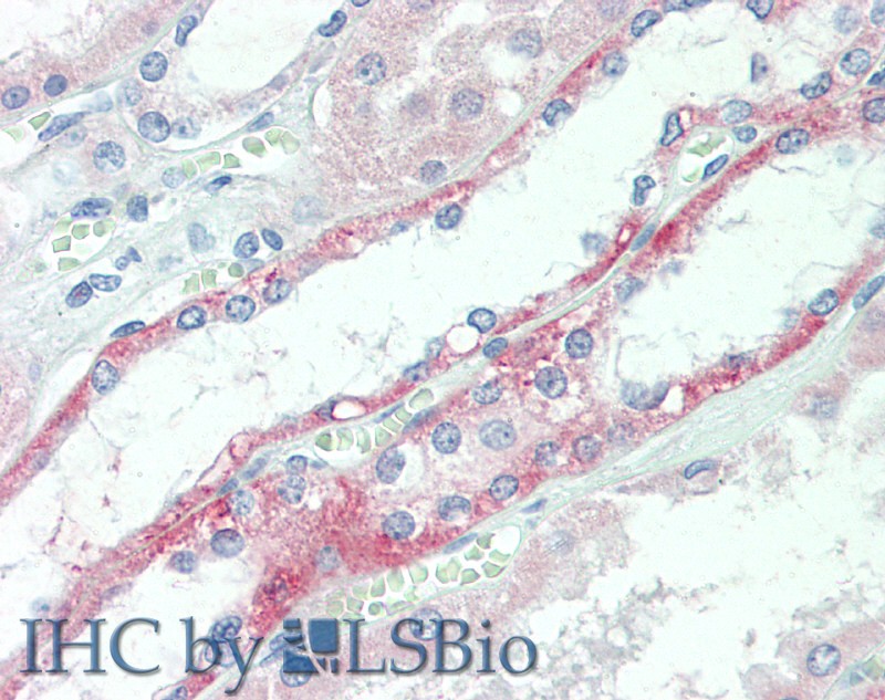 Immunohistochemistry of paraffin-embedded Kidney tissue using Claudin 10 Polyclonal Antibody at dilution of 1:60(Elabscience Product Detected by Lifespan).