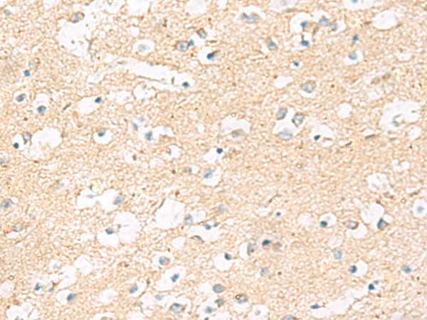 Immunohistochemistry of paraffin-embedded Human brain tissue  using MRPL20 Polyclonal Antibody at dilution of 1:60(?200)