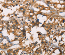 SENP1 Polyclonal Antibody - 3