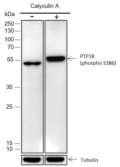 Recombinant Phospho-PTP1B (Ser386) Monoclonal Antibody-searchlist-1