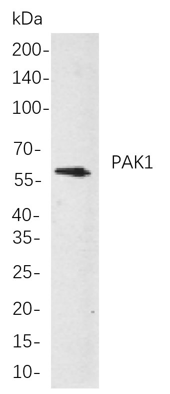 Recombinant PAK1 Monoclonal Antibody-searchlist-1