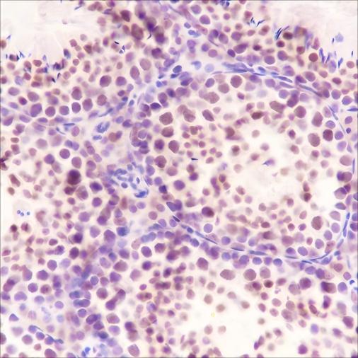 Recombinant SF1 Monoclonal Antibody - 3