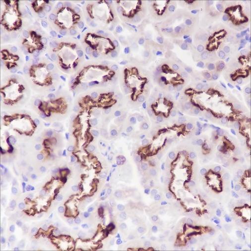 Recombinant Alpha B Crystallin Monoclonal Antibody - small - 5