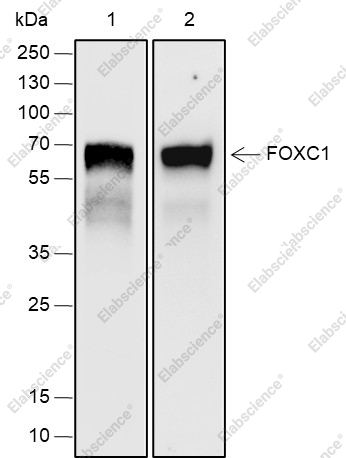 Recombinant FOXC1 Monoclonal Antibody - 1