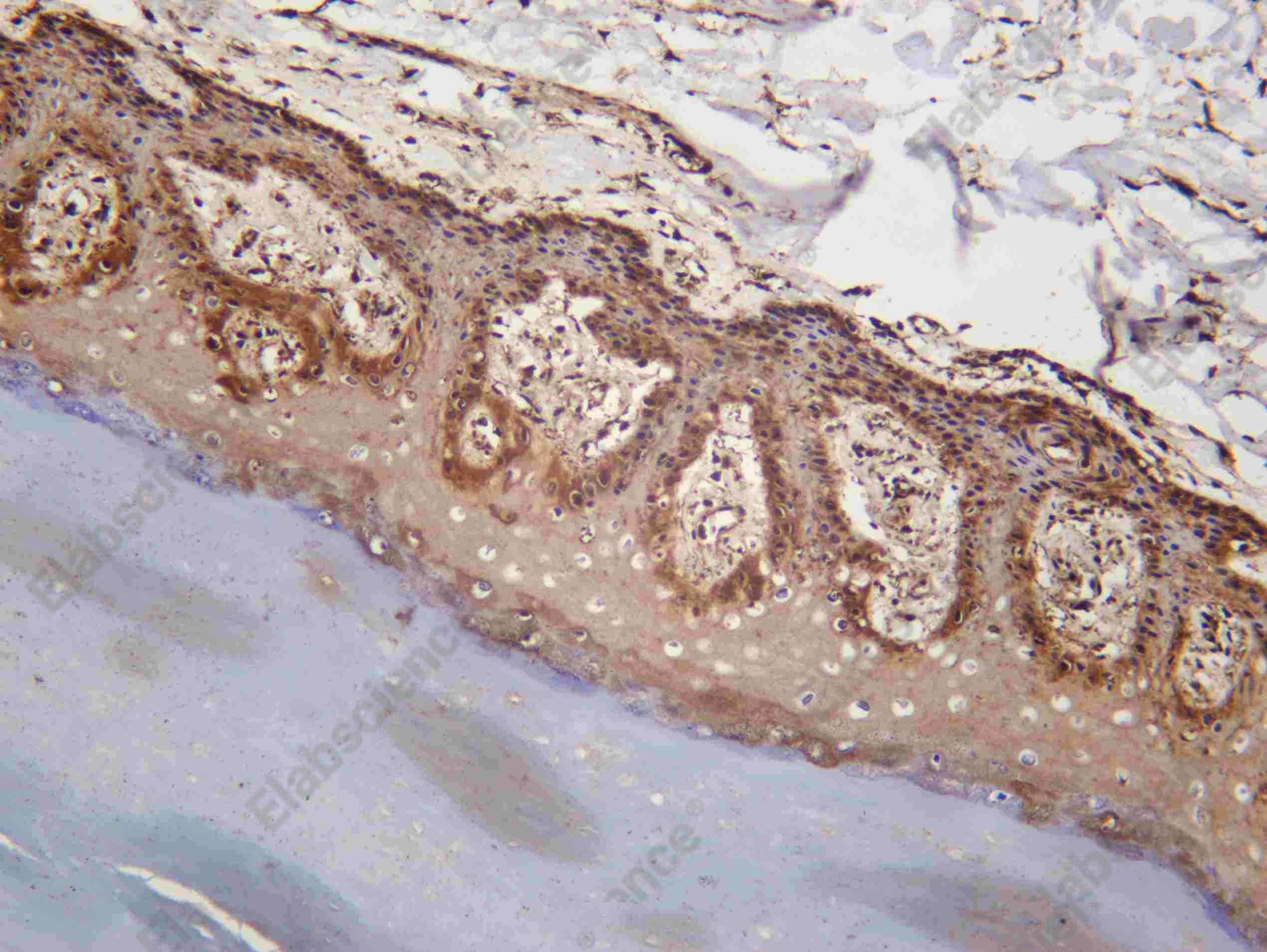 Recombinant TF Monoclonal Antibody - 2