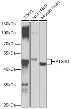 Western blot analysis of extracts of various cell lines using ATG4D Polyclonal Antibody at 1:1000 dilution.