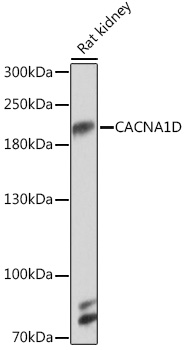 Western blot analysis of extracts of Rat kidney using CACNA1D Polyclonal Antibody at 1:1000 dilution.