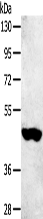 Western Blot analysis of 231 cell using SULT2B1 Polyclonal Antibody at dilution of 1:800