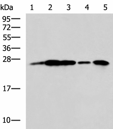 Western blot analysis of A549 cell Rat brain tissue Mouse brain tissue A172 cell Human cerebrum tissue lysates  using UCHL1 Polyclonal Antibody at dilution of 1:800