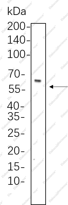 Recombinant Smad4 Monoclonal Antibody - 1