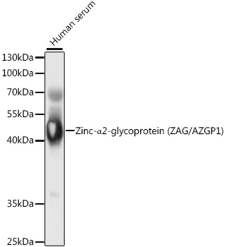 Western blot analysis of extracts of human serum using Zinc-α2-glycoprotein (ZAG/Zinc-α2-glycoprotein (ZAG/AZGP1)) Polyclonal Antibody at 1:1000 dilution.