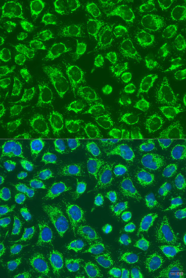 Immunofluorescence analysis of U2OS cells using MAP4K5 Polyclonal Antibody at dilution of  1:100. Blue: DAPI for nuclear staining.