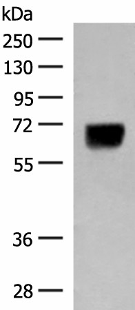 Western blot analysis of Human thyroid tissue lysate  using DGLUCY Polyclonal Antibody at dilution of 1:250