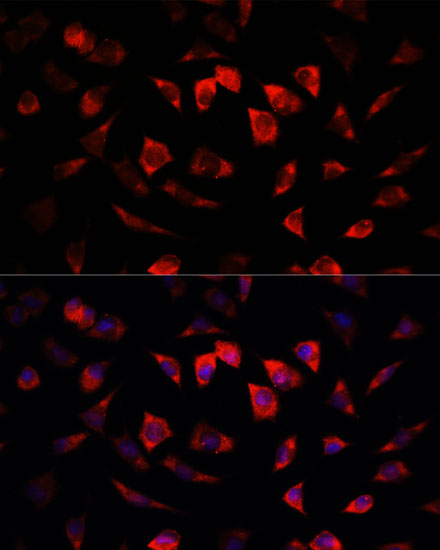 Immunofluorescence analysis of L929 cells using IGFBP4 Polyclonal Antibody at dilution of 1:100. Blue: DAPI for nuclear staining.