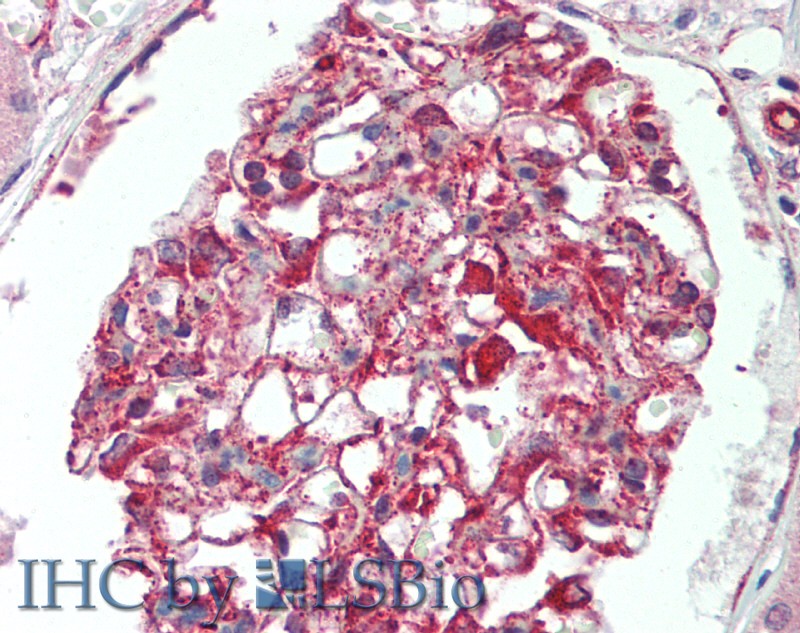 Immunohistochemistry of paraffin-embedded Kidney tissue using IL17RB Polyclonal Antibody at dilution of 1:120 (Elabscience Product Detected by Lifespan).