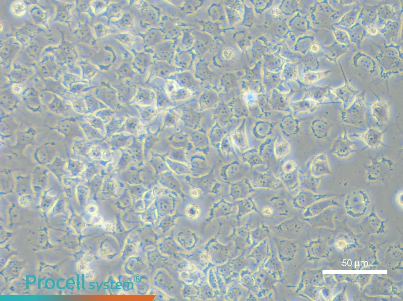 92-1 [Human uveal melanoma] - 6