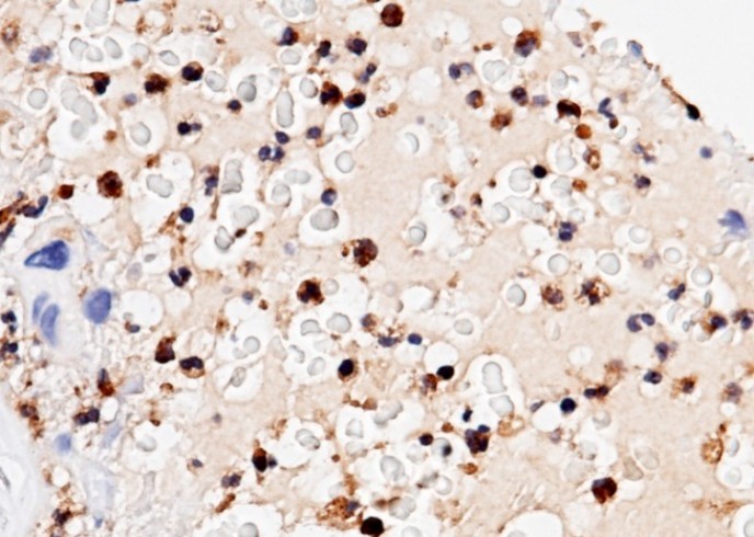 Recombinant Ficolin-1/Ficolin-A/FCN1 Monoclonal Antibody - small - 2