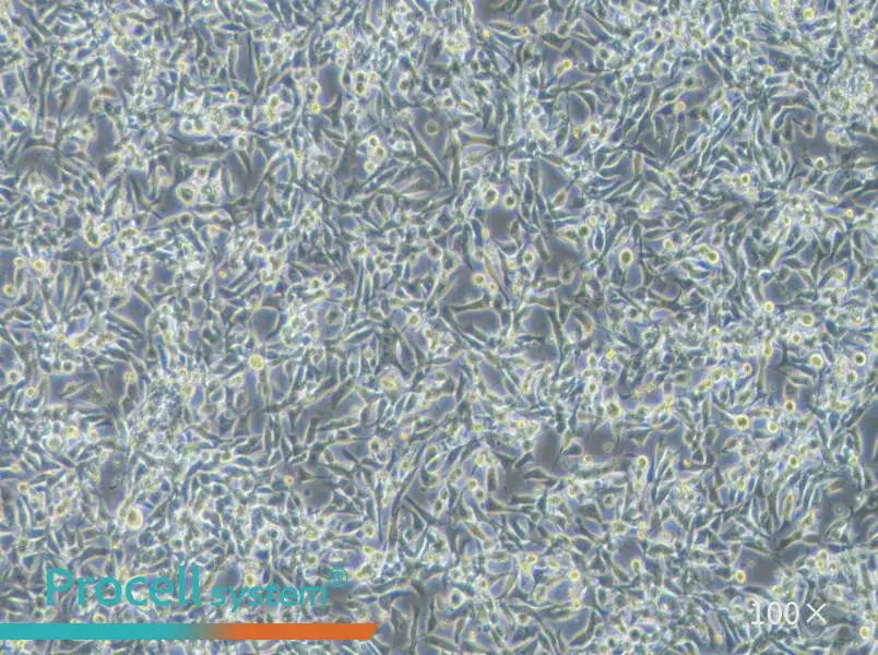 EBC-1 Cell Complete MediumEBC-1 Cell Complete Medium - 3