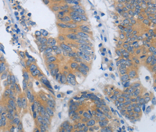CD10 Polyclonal Antibody - 2