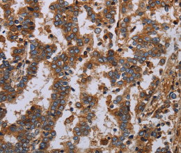 GDF2 Polyclonal Antibody - 3