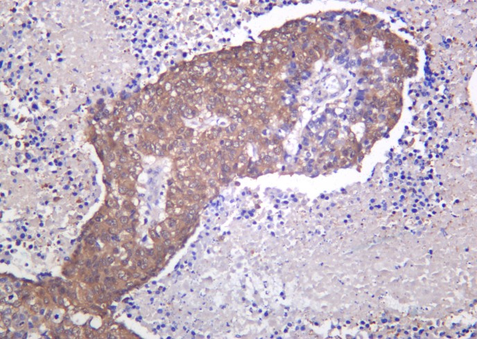 Recombinant PARK7 Monoclonal Antibody-searchlist-1