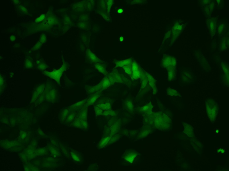 U-2 OS-LUC-EGFP Cell Complete MediumU-2 OS-LUC-EGFP Cell Complete Medium - 2